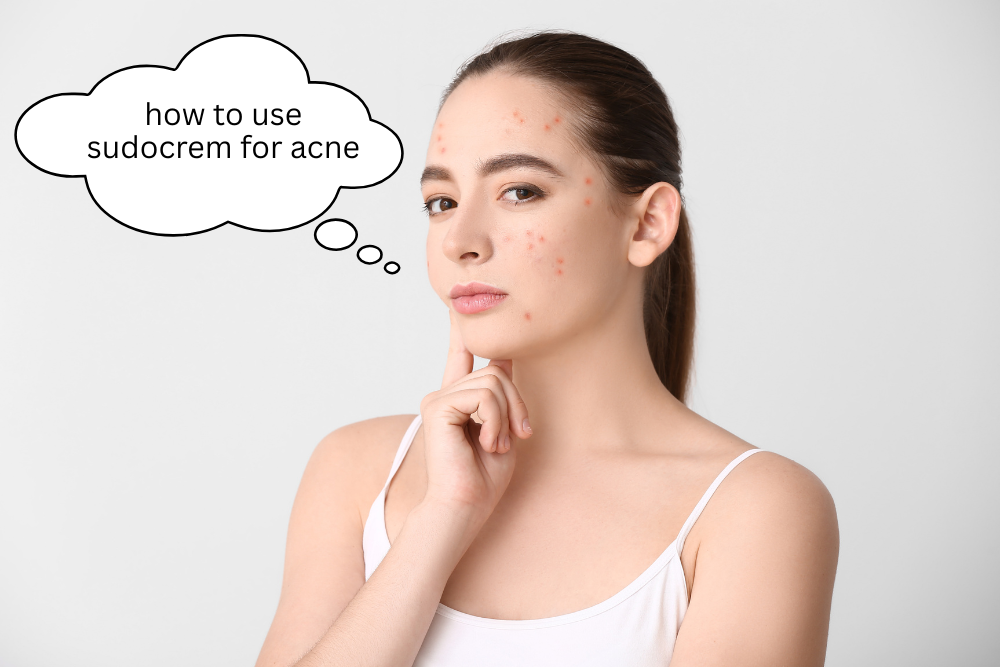 how to use sudocrem for acne